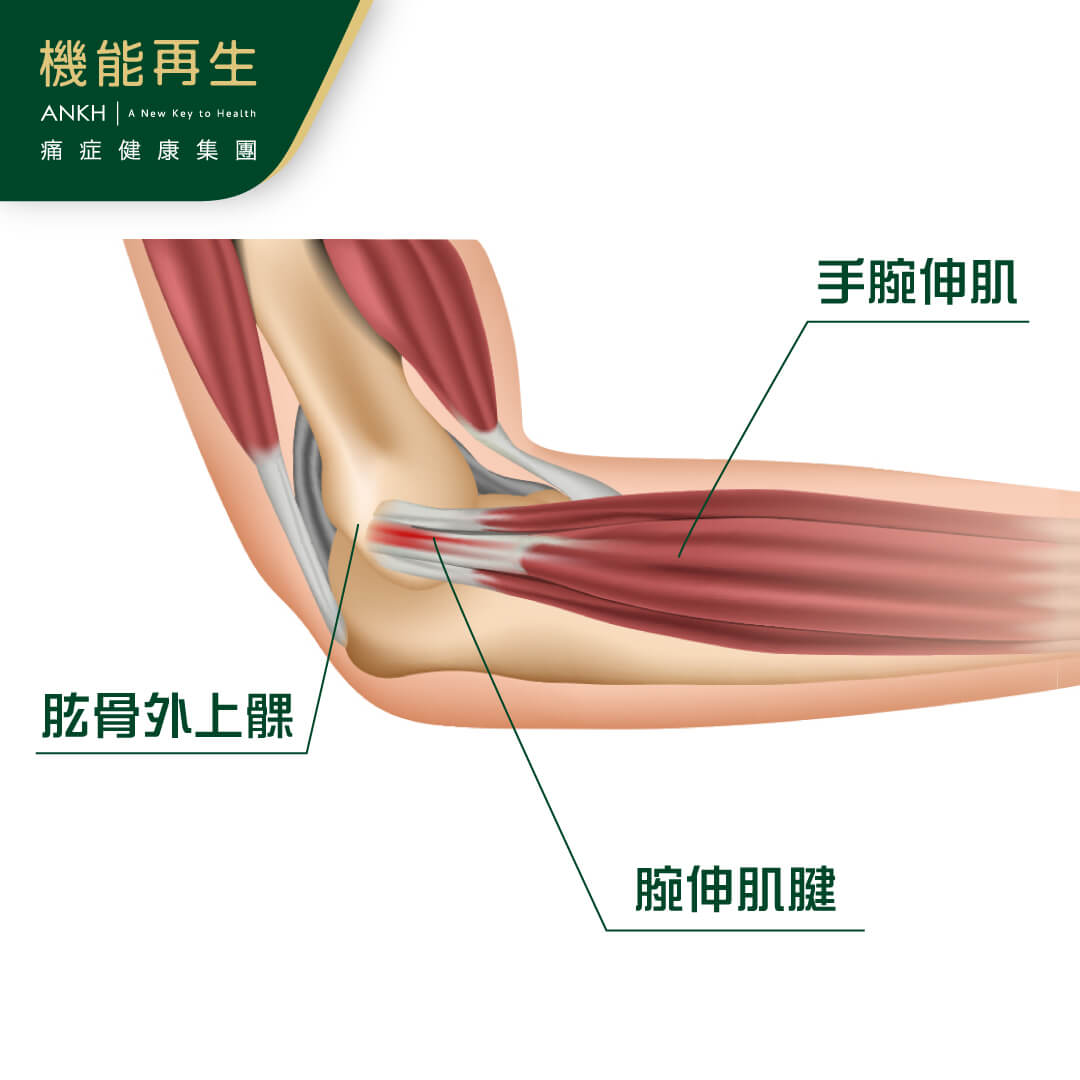 手肘、手臂結構解剖圖看網球手